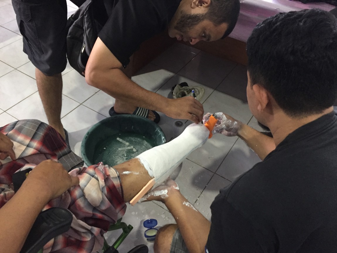 Two men helping an elderly make a prosthetics leg