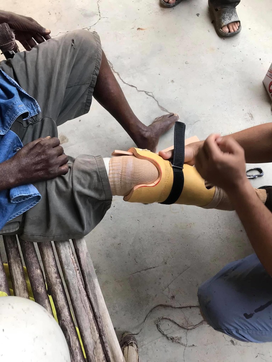 A man helping another man put on prosthetics leg